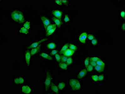 NAA38 / LSMD1 Antibody - Immunofluorescence staining of PC-3 cells with NAA38 Antibody at 1:133, counter-stained with DAPI. The cells were fixed in 4% formaldehyde, permeabilized using 0.2% Triton X-100 and blocked in 10% normal Goat Serum. The cells were then incubated with the antibody overnight at 4°C. The secondary antibody was Alexa Fluor 488-congugated AffiniPure Goat Anti-Rabbit IgG(H+L).