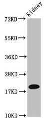 NAA38 / LSMD1 Antibody - Western Blot Positive WB detected in: Mouse kidney tissue All lanes: NAA38 antibody at 4µg/ml Secondary Goat polyclonal to rabbit IgG at 1/50000 dilution Predicted band size: 14, 19 kDa Observed band size: 19 kDa