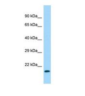 NAA40 Antibody - Western blot of Mouse Stomach. Naa40 antibody dilution 1.0 ug/ml.  This image was taken for the unconjugated form of this product. Other forms have not been tested.