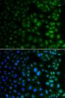 NAA40 Antibody - Immunofluorescence analysis of A549 cells using NAA40 Polyclonal Antibody.