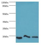 NAA50 / NAT13 / SAN Antibody - Western blot. All lanes: NAA50 antibody at 5 ug/ml. Lane 1: k562 whole cell lysate. Lane 2: Jurkat whole cell lysate. Lane 3: HeLa whole cell lysate. Secondary antibody: Goat polyclonal to rabbit at 1:10000 dilution. Predicted band size: 19 kDa. Observed band size: 19 kDa.