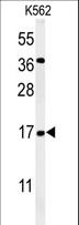 NAA50 / NAT13 / SAN Antibody - Western blot of NAT13 Antibody in K562 cell line lysates (35 ug/lane). NAT13 (arrow) was detected using the purified antibody.