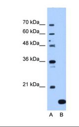 NAA50 / NAT13 / SAN Antibody - Lane A: Marker. Lane B: Jurkat cell lysate. Antibody concentration: 1.25 ug/ml. Gel concentration: 12%.  This image was taken for the unconjugated form of this product. Other forms have not been tested.