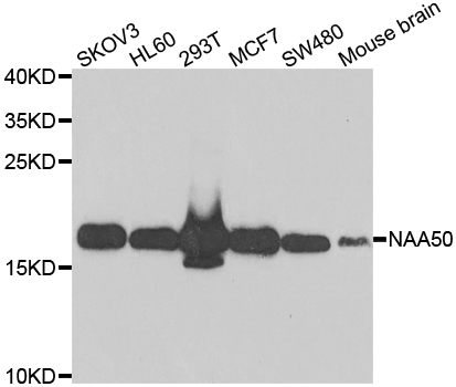 NAA50 / NAT13 / SAN Antibody - Western blot analysis of extracts of various cell lines.