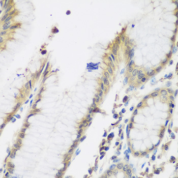 NAA50 / NAT13 / SAN Antibody - Immunohistochemistry of paraffin-embedded human stomach tissue.