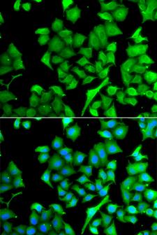 NAA50 / NAT13 / SAN Antibody - Immunofluorescence analysis of A549 cells.