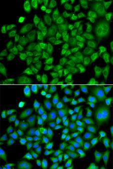 NAA50 / NAT13 / SAN Antibody - Immunofluorescence analysis of A549 cells.