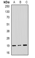 NAA50 / NAT13 / SAN Antibody - Western blot analysis of NAT13 expression in SKOV3 (A); MCF7 (B); mouse brain (C) whole cell lysates.
