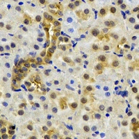 NAA50 / NAT13 / SAN Antibody - Immunohistochemical analysis of NAT13 staining in rat kidney formalin fixed paraffin embedded tissue section. The section was pre-treated using heat mediated antigen retrieval with sodium citrate buffer (pH 6.0). The section was then incubated with the antibody at room temperature and detected using an HRP conjugated compact polymer system. DAB was used as the chromogen. The section was then counterstained with hematoxylin and mounted with DPX.
