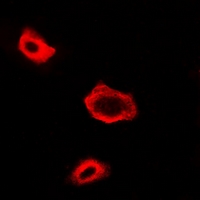 NAA50 / NAT13 / SAN Antibody - Immunofluorescent analysis of NAT13 staining in A549 cells. Formalin-fixed cells were permeabilized with 0.1% Triton X-100 in TBS for 5-10 minutes and blocked with 3% BSA-PBS for 30 minutes at room temperature. Cells were probed with the primary antibody in 3% BSA-PBS and incubated overnight at 4 deg C in a humidified chamber. Cells were washed with PBST and incubated with a DyLight 594-conjugated secondary antibody (red) in PBS at room temperature in the dark.