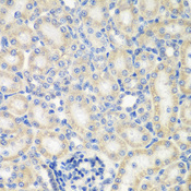 NAA50 / NAT13 / SAN Antibody - Immunohistochemistry of paraffin-embedded rat kidney using NAA50 antibody at dilution of 1:200 (40x lens).