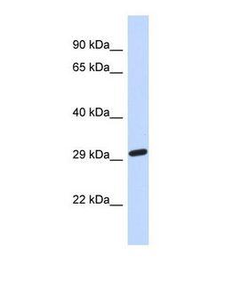 NAALAD2 Antibody - Western blot of Human Fetal Brain. NAALAD2 antibody dilution 1.0 ug/ml.  This image was taken for the unconjugated form of this product. Other forms have not been tested.