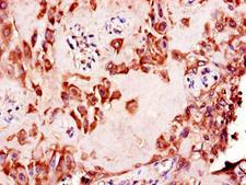 NAALADL2 Antibody - Immunohistochemistry of paraffin-embedded human placenta tissue using NAALADL2 Antibody at dilution of 1:100