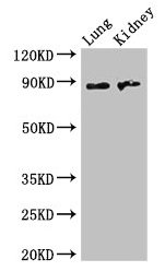 NAALADL2 Antibody - Western Blot Positive WB detected in: mouse lung tissue, Mouse kidney tissue All lanes: NAALADL2 antibody at 3.5µg/ml Secondary Goat polyclonal to rabbit IgG at 1/50000 dilution Predicted band size: 89, 37 kDa Observed band size: 89 kDa