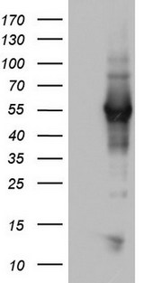 NAB1 Antibody - HEK293T cells were transfected with the pCMV6-ENTRY control (Left lane) or pCMV6-ENTRY NAB1 (Right lane) cDNA for 48 hrs and lysed. Equivalent amounts of cell lysates (5 ug per lane) were separated by SDS-PAGE and immunoblotted with anti-NAB1.