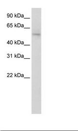 NAB1 Antibody - Transfected 293T Cell Lysate.  This image was taken for the unconjugated form of this product. Other forms have not been tested.