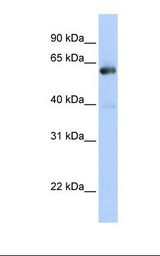NAB1 Antibody - Transfected 293T cell lysate. Antibody concentration: 1.0 ug/ml. Gel concentration: 12%.  This image was taken for the unconjugated form of this product. Other forms have not been tested.