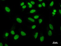 NAB1 Antibody - Immunostaining analysis in HeLa cells. HeLa cells were fixed with 4% paraformaldehyde and permeabilized with 0.1% Triton X-100 in PBS. The cells were immunostained with anti-NAB1 mAb.
