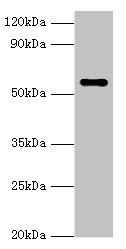 NAB2 Antibody - Western blot All lanes: NAB2 antibody at 3µg/ml + Hela whole cell lysate Secondary Goat polyclonal to rabbit IgG at 1/10000 dilution Predicted band size: 57, 35, 50 kDa Observed band size: 57 kDa
