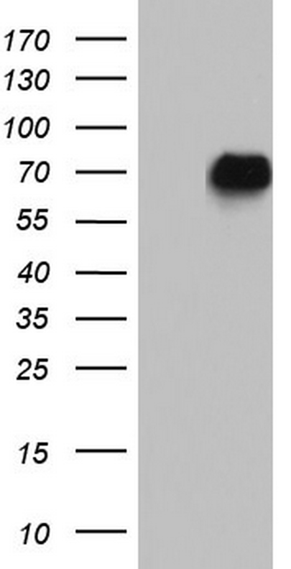 NAB2 Antibody - HEK293T cells were transfected with the pCMV6-ENTRY control (Left lane) or pCMV6-ENTRY NAB2 (Right lane) cDNA for 48 hrs and lysed. Equivalent amounts of cell lysates (5 ug per lane) were separated by SDS-PAGE and immunoblotted with anti-NAB2.