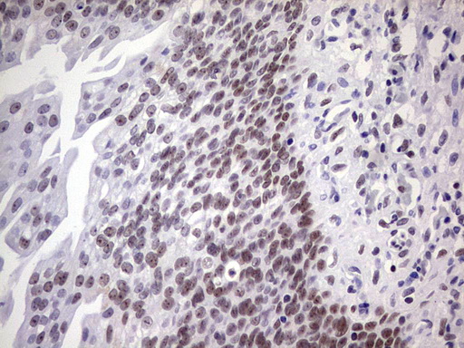NAB2 Antibody - IHC of paraffin-embedded Human bladder tissue using anti-NAB2 mouse monoclonal antibody. (Heat-induced epitope retrieval by 1 mM EDTA in 10mM Tris, pH8.5, 120°C for 3min).