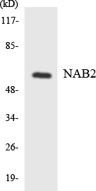 NAB2 Antibody - Western blot analysis of the lysates from HeLa cells using NAB2 antibody.