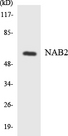 NAB2 Antibody - Western blot analysis of the lysates from HeLa cells using NAB2 antibody.
