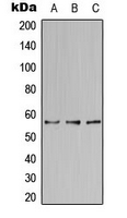 NAB2 Antibody - Western blot analysis of NAB2 expression in HepG2 (A); HeLa (B); Raw264.7 (C) whole cell lysates.