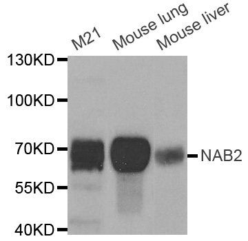 NAB2 Antibody - Western blot analysis of extracts of various cell lines.