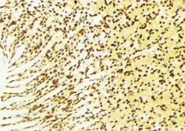 NAB2 Antibody - 1:100 staining human gastric tissue by IHC-P. The sample was formaldehyde fixed and a heat mediated antigen retrieval step in citrate buffer was performed. The sample was then blocked and incubated with the antibody for 1.5 hours at 22°C. An HRP conjugated goat anti-rabbit antibody was used as the secondary.