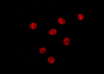 NAB2 Antibody - Staining HT29 cells by IF/ICC. The samples were fixed with PFA and permeabilized in 0.1% Triton X-100, then blocked in 10% serum for 45 min at 25°C. The primary antibody was diluted at 1:200 and incubated with the sample for 1 hour at 37°C. An Alexa Fluor 594 conjugated goat anti-rabbit IgG (H+L) antibody, diluted at 1/600, was used as secondary antibody.