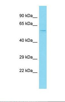 NAB2 Antibody - Western blot of Human Fetal Thymus. NAB2 antibody dilution 1.0 ug/ml.  This image was taken for the unconjugated form of this product. Other forms have not been tested.