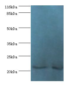NABP1 / OBFC2A Antibody - Western blot. All lanes: SOSS complex subunit B2 antibody at 2 ug/ml Lane 1:HeLa whole cell lysate. Lane 2: Jurkat whole cell lysate. Secondary antibody: Goat polyclonal to rabbit at 1:10000 dilution. Predicted band size: 22 kDa. Observed band size: 22 kDa.  This image was taken for the unconjugated form of this product. Other forms have not been tested.