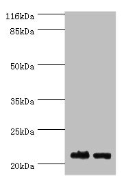 NABP1 / OBFC2A Antibody - Western blot All lanes: NABP1 antibody at 2µg/ml Lane 1: Hela whole cell lysate Lane 2: Jurkat whole cell lysate Secondary Goat polyclonal to rabbit IgG at 1/10000 dilution Predicted band size: 23, 14, 15 kDa Observed band size: 23 kDa