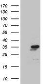 NABP1 / OBFC2A Antibody - HEK293T cells were transfected with the pCMV6-ENTRY control. (Left lane) or pCMV6-ENTRY NABP1. (Right lane) cDNA for 48 hrs and lysed. Equivalent amounts of cell lysates. (5 ug per lane) were separated by SDS-PAGE and immunoblotted with anti-NABP1. (1:2000)