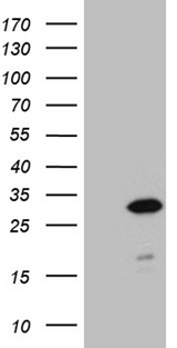 NABP1 / OBFC2A Antibody - HEK293T cells were transfected with the pCMV6-ENTRY control. (Left lane) or pCMV6-ENTRY NABP1. (Right lane) cDNA for 48 hrs and lysed