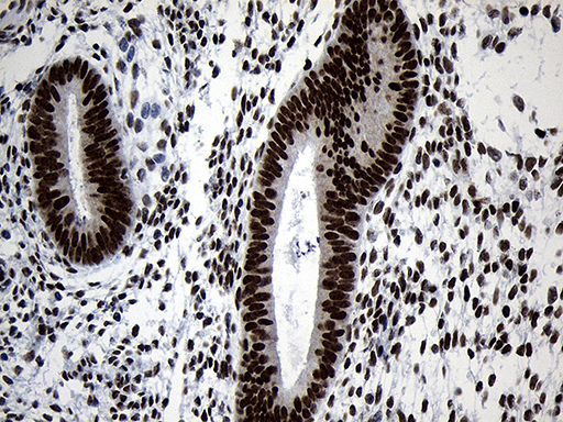 NABP1 / OBFC2A Antibody - Immunohistochemical staining of paraffin-embedded Human endometrium tissue within the normal limits using anti-NABP1 mouse monoclonal antibody. (Heat-induced epitope retrieval by 1mM EDTA in 10mM Tris buffer. (pH8.5) at 120°C for 3 min. (1:500)