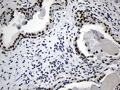 NABP1 / OBFC2A Antibody - Immunohistochemical staining of paraffin-embedded Human prostate tissue within the normal limits using anti-NABP1 mouse monoclonal antibody. (Heat-induced epitope retrieval by 1mM EDTA in 10mM Tris buffer. (pH8.5) at 120°C for 3 min. (1:500)