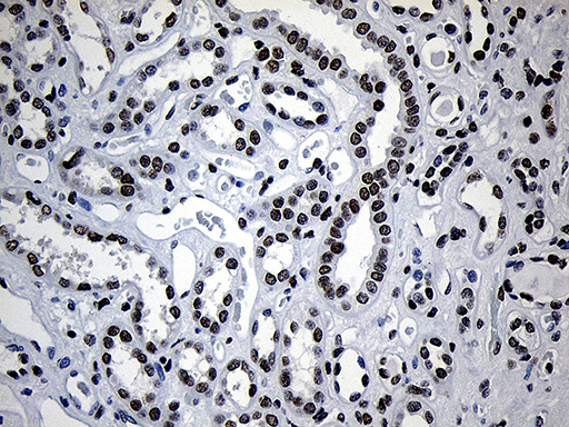 NABP1 / OBFC2A Antibody - Immunohistochemical staining of paraffin-embedded Human Kidney tissue within the normal limits using anti-NABP1 mouse monoclonal antibody. (Heat-induced epitope retrieval by 1mM EDTA in 10mM Tris buffer. (pH8.5) at 120°C for 3 min. (1:500)