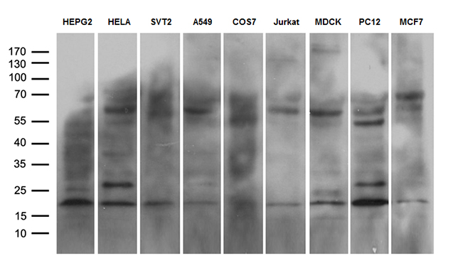 NABP1 / OBFC2A Antibody - Western blot analysis of extracts. (35ug) from 9 different cell lines by using anti-NABP1 monoclonal antibody. (1:500)