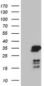 NABP1 / OBFC2A Antibody - HEK293T cells were transfected with the pCMV6-ENTRY control. (Left lane) or pCMV6-ENTRY NABP1. (Right lane) cDNA for 48 hrs and lysed