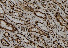 NABP1 / OBFC2A Antibody - 1:100 staining human kidney tissue by IHC-P. The sample was formaldehyde fixed and a heat mediated antigen retrieval step in citrate buffer was performed. The sample was then blocked and incubated with the antibody for 1.5 hours at 22°C. An HRP conjugated goat anti-rabbit antibody was used as the secondary.