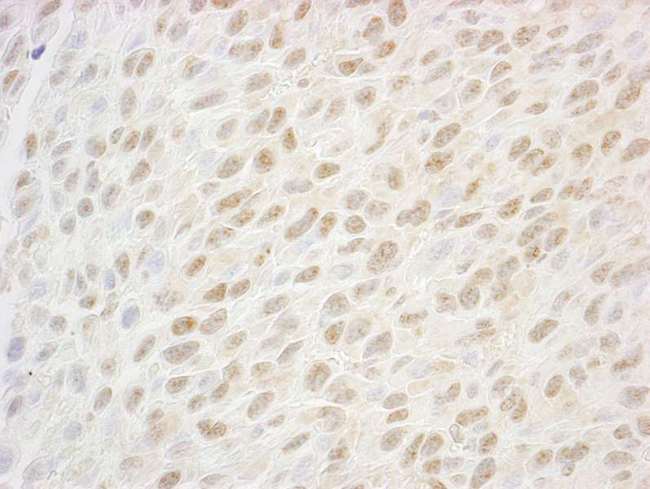 NABP2 Antibody - Detection of Mouse SSB1 by Immunohistochemistry. Sample: FFPE section of mouse squamous cell carcinoma. Antibody: Affinity purified rabbit anti-SSB1 used at a dilution of 1:100.