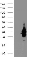NABP2 Antibody - HEK293T cells were transfected with the pCMV6-ENTRY control (Left lane) or pCMV6-ENTRY OBFC2B (Right lane) cDNA for 48 hrs and lysed. Equivalent amounts of cell lysates (5 ug per lane) were separated by SDS-PAGE and immunoblotted with anti-OBFC2B.