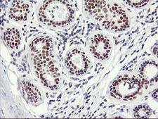 NABP2 Antibody - IHC of paraffin-embedded Human breast tissue using anti-OBFC2B mouse monoclonal antibody.