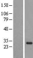 NABP2 Protein - Western validation with an anti-DDK antibody * L: Control HEK293 lysate R: Over-expression lysate