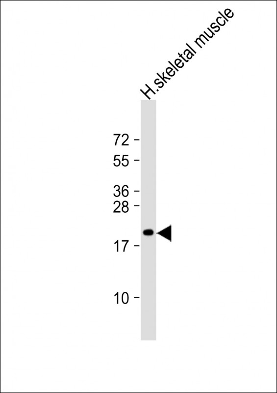 NACA Antibody - Anti-NACA2 Antibody (N-Term) at 1:2000 dilution + human skeletal muscle lysate Lysates/proteins at 20 ug per lane. Secondary Goat Anti-Rabbit IgG, (H+L), Peroxidase conjugated at 1:10000 dilution. Predicted band size: 23 kDa. Blocking/Dilution buffer: 5% NFDM/TBST.