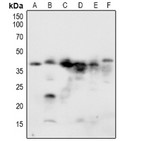 NACA Antibody - Western blot analysis of NACA1 (pS43) expression in HEK293T (A), Jurkat (B), NIH3T3 (C), CT26 (D), H9C2 (E), PC12 (F) whole cell lysates.
