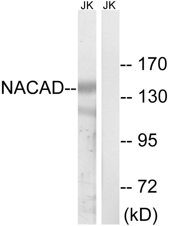 NACAD Antibody - Western blot analysis of lysates from Jurkat cells, using NACAD Antibody. The lane on the right is blocked with the synthesized peptide.