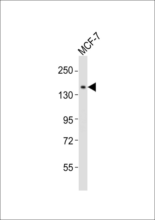NACAD Antibody - Anti-NACAD Antibody at 1:1000 dilution + MCF-7 whole cell lysates Lysates/proteins at 20 ug per lane. Secondary Goat Anti-Rabbit IgG, (H+L),Peroxidase conjugated at 1/10000 dilution Predicted band size : 161 kDa Blocking/Dilution buffer: 5% NFDM/TBST.